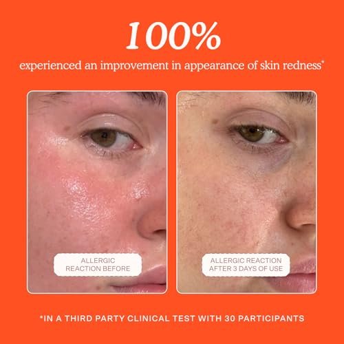 Tower 28 SOS Daily Rescue Facial Spray - Hypochlorous Acid Spray to Help Visibly Calm + Soothe Sensitive Skin - Purifying Travel Size Face Toner - Everyday Skin Care Essential (1 oz) - Image 3